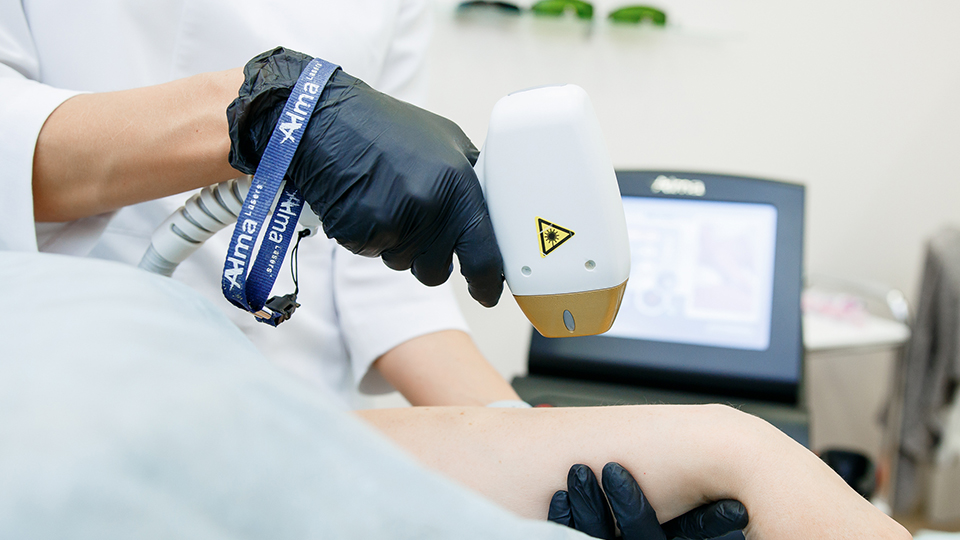 Лазерная эпиляция нового поколения Soprano Ice Platinum