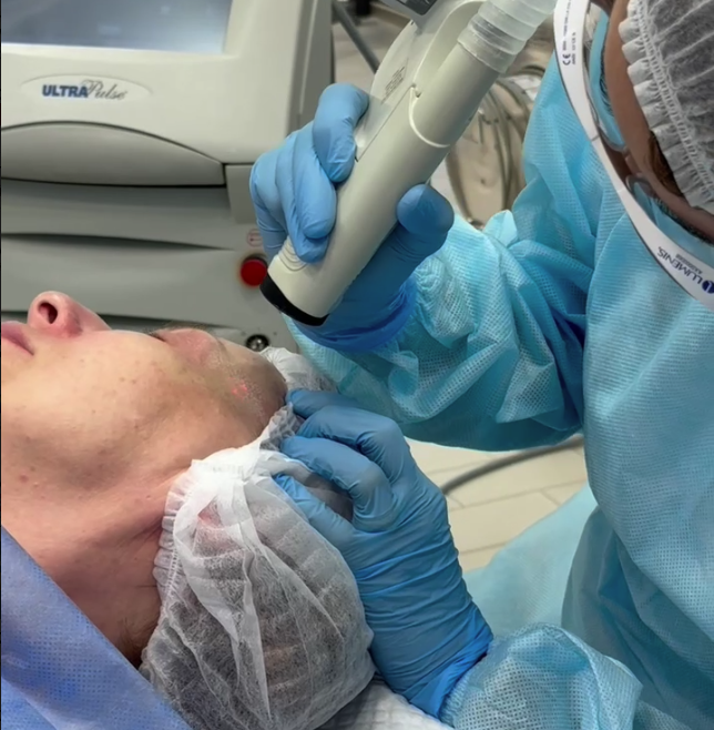 СЕЙЧАС — ИДЕАЛЬНОЕ ВРЕМЯ ДЛЯ ЛАЗЕРНЫХ ШЛИФОВОК!