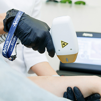 Лазерная эпиляция на аппарате Soprano XL (Alma Laser) Израиль