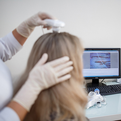 Трихоскопия — что это и зачем она нужна?