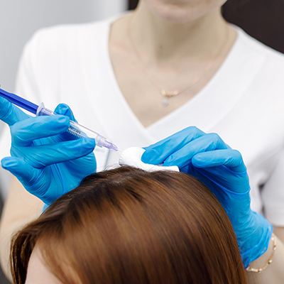 Мезотерапия кожи головы: восстановление волос изнутри