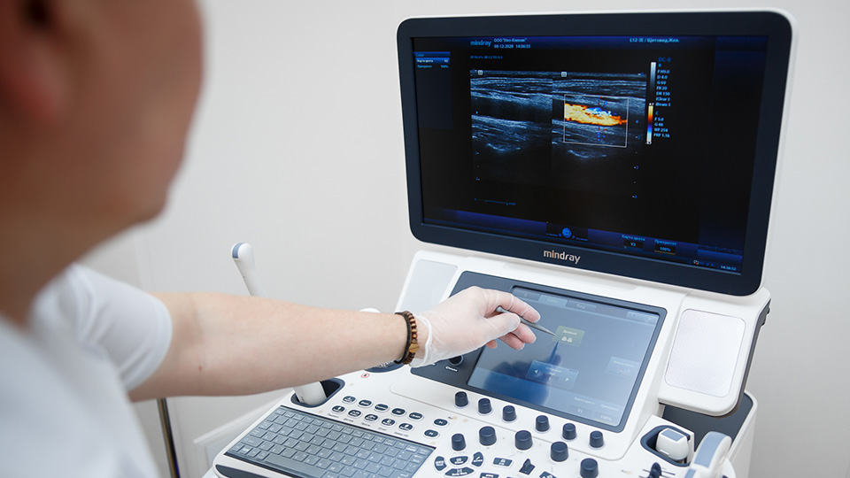 УЗИ слюнных желез